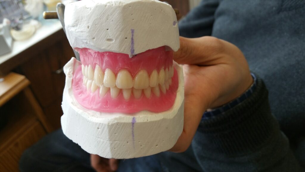 denture setup